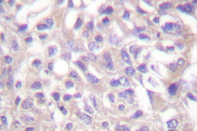 Phospho-alpha Adducin (Thr445) Antibody in Immunohistochemistry (Paraffin) (IHC (P))