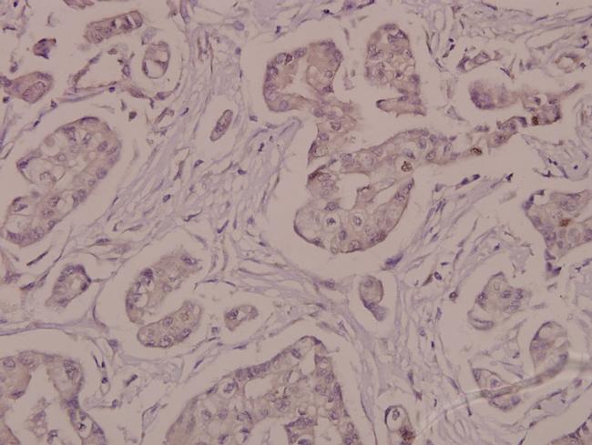 Phospho-ATP1A1 (Ser16) Antibody in Immunohistochemistry (Paraffin) (IHC (P))