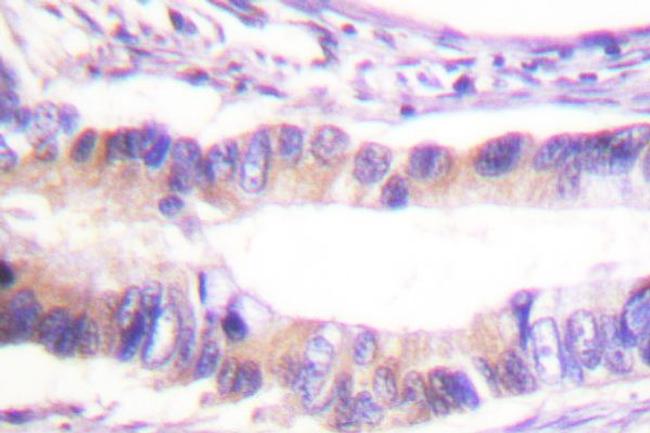 Phospho-c-Cbl (Tyr674) Antibody in Immunohistochemistry (Paraffin) (IHC (P))