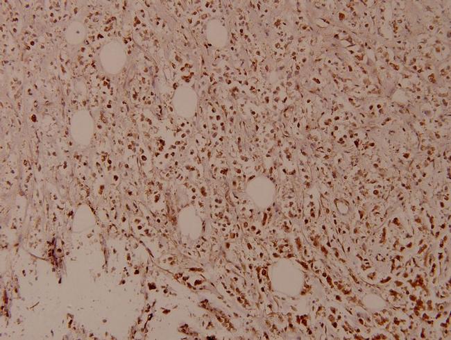 Phospho-MDM2 (Ser166) Antibody in Immunohistochemistry (Paraffin) (IHC (P))