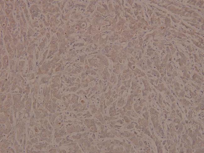 Phospho-INSR (Tyr1361) Antibody in Immunohistochemistry (Paraffin) (IHC (P))