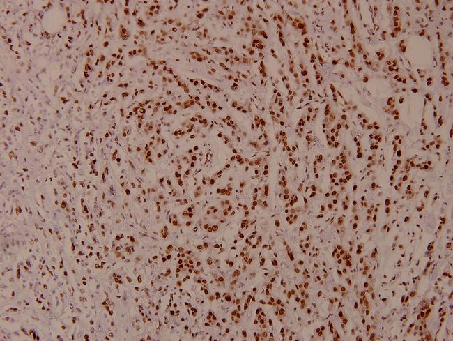 Phospho-STAT5 alpha/beta (Ser726, Ser731) Antibody in Immunohistochemistry (Paraffin) (IHC (P))