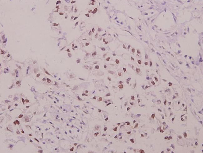 Phospho-p47phox (Ser304) Antibody in Immunohistochemistry (Paraffin) (IHC (P))