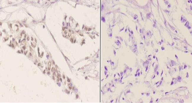 Phospho-ATF2 (Ser498) Antibody in Immunohistochemistry (Paraffin) (IHC (P))