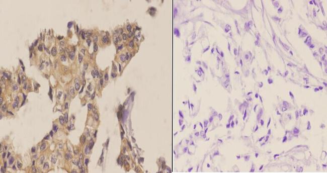 Phospho-ABL1/ABL2 (Tyr393, Tyr439) Antibody in Immunohistochemistry (Paraffin) (IHC (P))