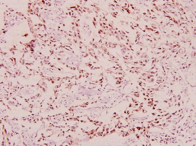 Phospho-BRCA1 (Ser1423) Antibody in Immunohistochemistry (Paraffin) (IHC (P))