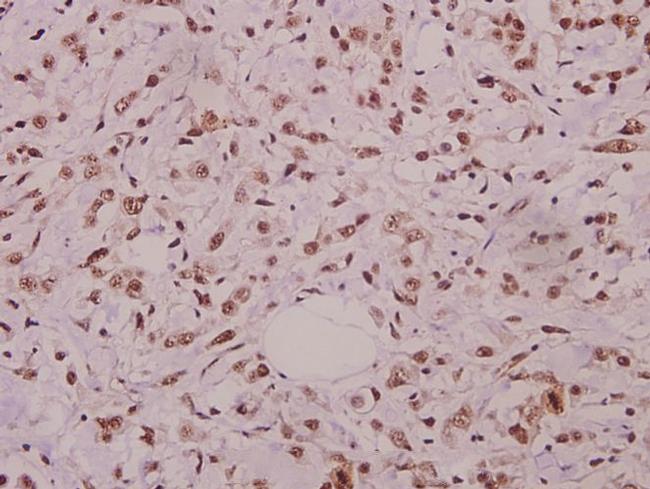 Phospho-JNK1/JNK2/JNK3 (Thr183) Antibody in Immunohistochemistry (Paraffin) (IHC (P))