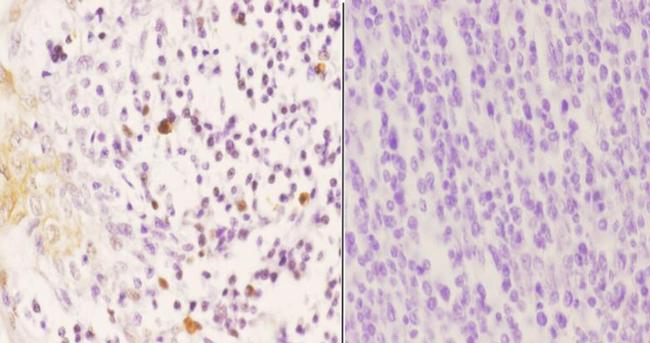 Phospho-p47phox (Ser370) Antibody in Immunohistochemistry (Paraffin) (IHC (P))