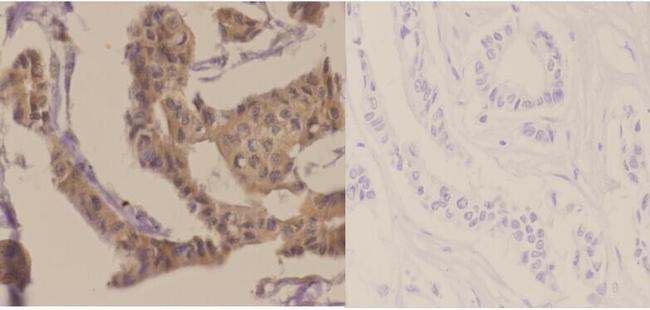 Phospho-p70 S6 Kinase (Thr421) Antibody in Immunohistochemistry (Paraffin) (IHC (P))