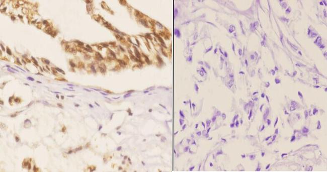 Phospho-SMAD1 (Ser187) Antibody in Immunohistochemistry (Paraffin) (IHC (P))