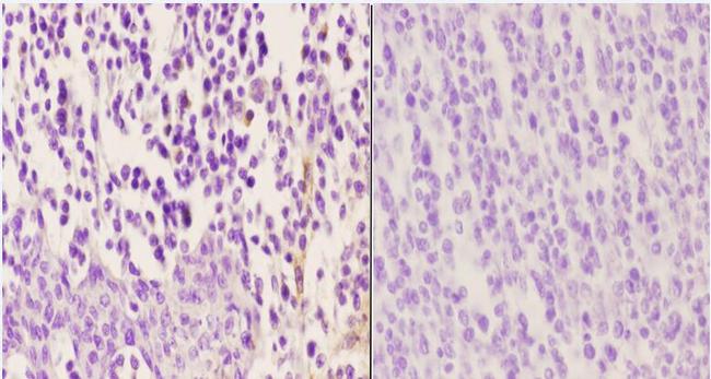 Phospho-Zap-70 (Tyr315) Antibody in Immunohistochemistry (Paraffin) (IHC (P))