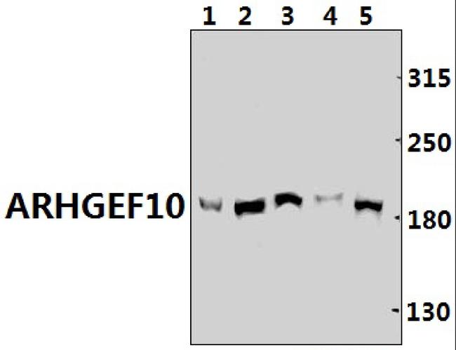 ARHGEF10 Antibody in Western Blot (WB)