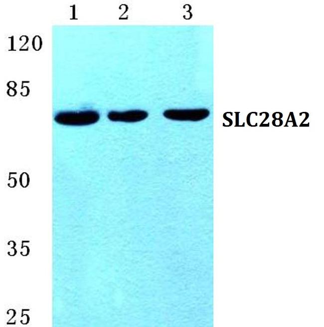 SLC28A2 Antibody in Western Blot (WB)