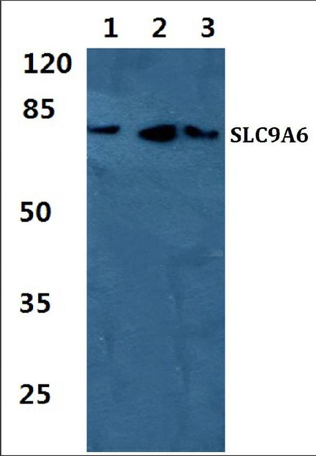 SLC9A6 Antibody in Western Blot (WB)