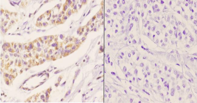 PEX11B Antibody in Immunohistochemistry (Paraffin) (IHC (P))