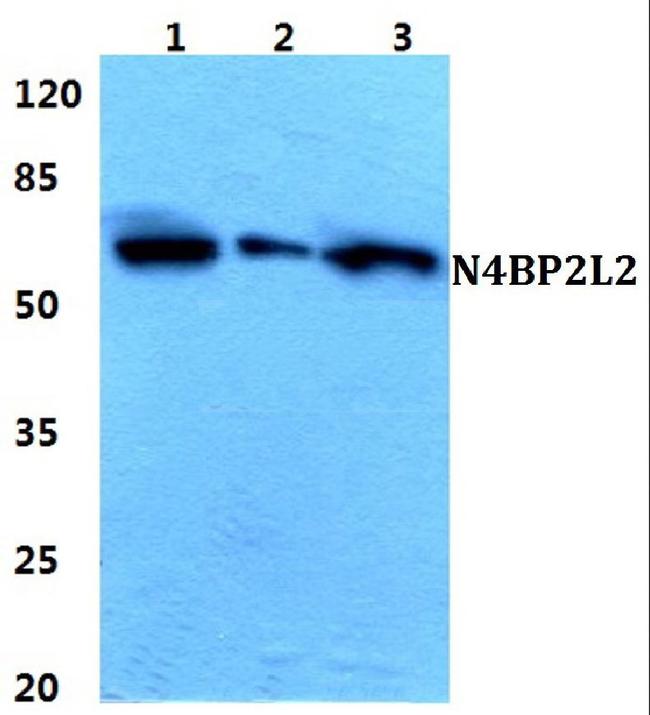 N4BP2L2 Antibody in Western Blot (WB)