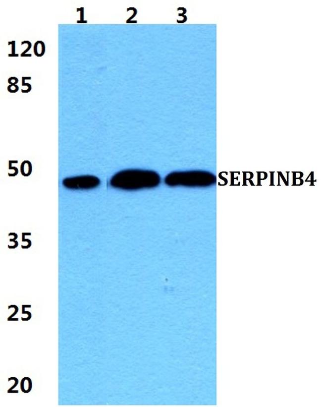 SERPINB4 Antibody in Western Blot (WB)