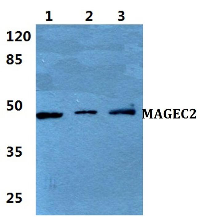 MAGEC2 Antibody in Western Blot (WB)