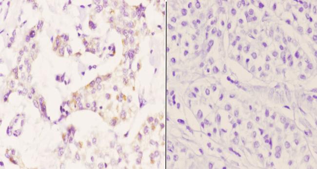 PTGR2 Antibody in Immunohistochemistry (Paraffin) (IHC (P))