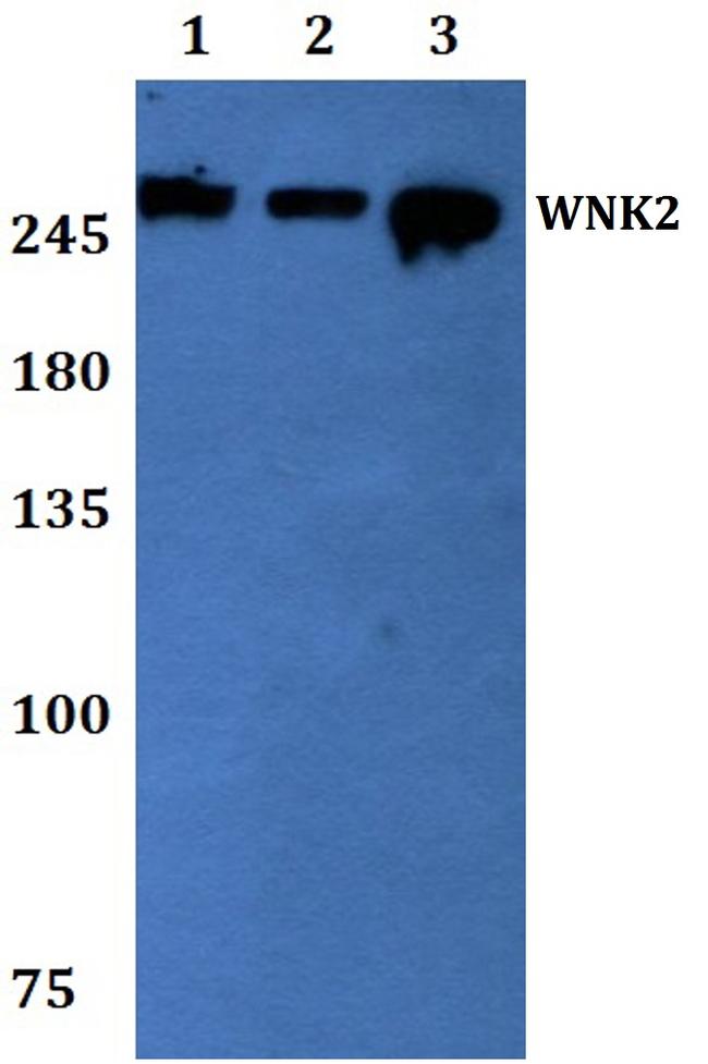 WNK2 Antibody in Western Blot (WB)