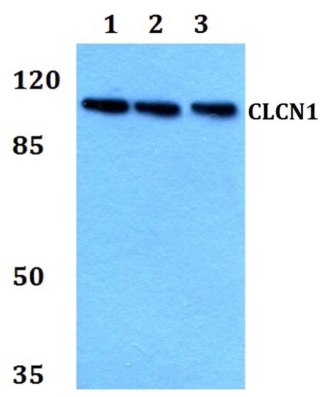 CLCN1 Antibody in Western Blot (WB)