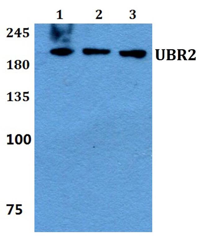 UBR2 Antibody in Western Blot (WB)