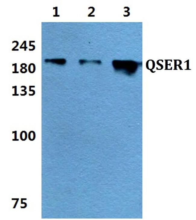 QSER1 Antibody in Western Blot (WB)