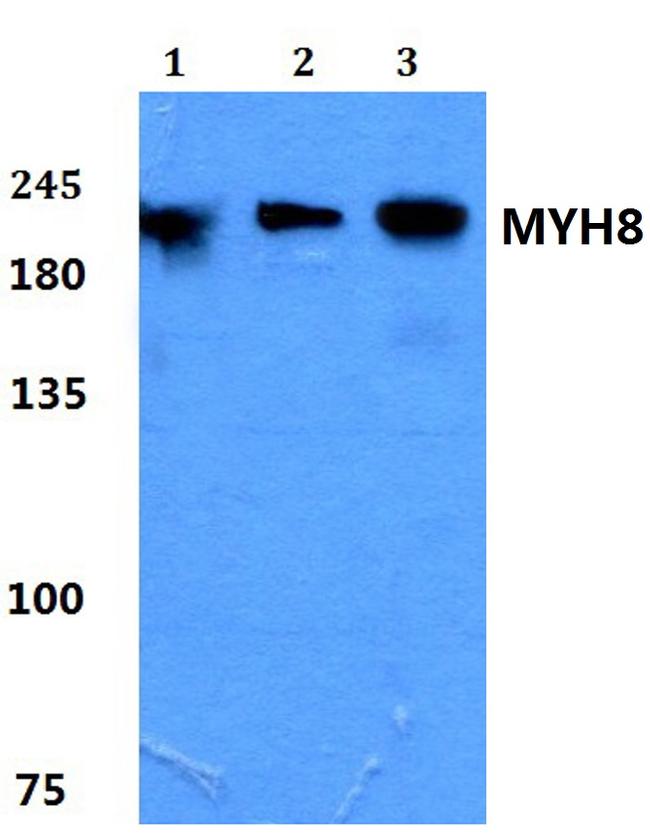 MYH8 Antibody in Western Blot (WB)