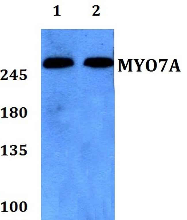 MYO7A Antibody in Western Blot (WB)