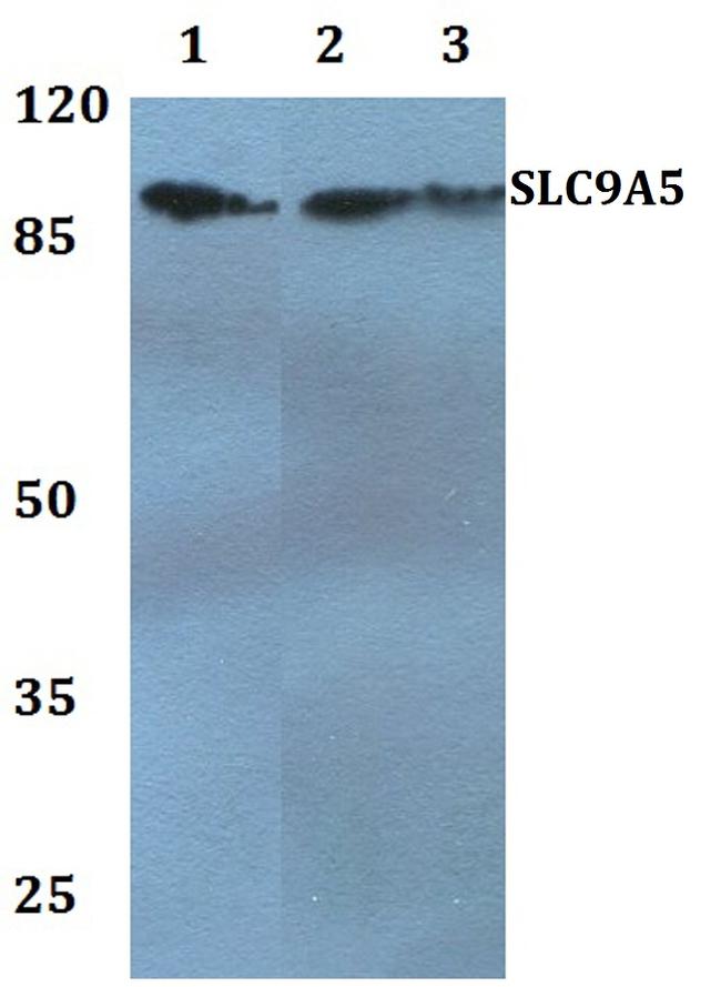 SLC9A5 Antibody in Western Blot (WB)