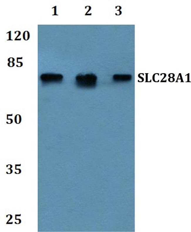 SLC28A1 Antibody in Western Blot (WB)