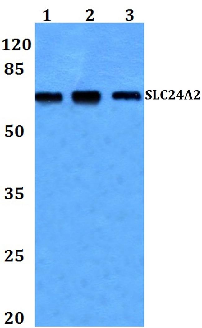 SLC24A2 Antibody in Western Blot (WB)