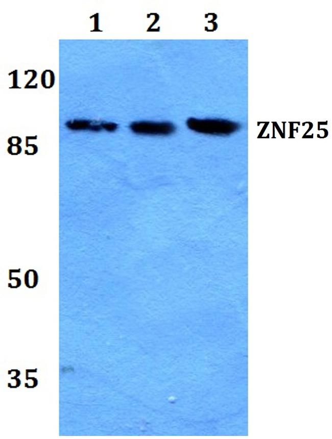 ZNF25 Antibody in Western Blot (WB)