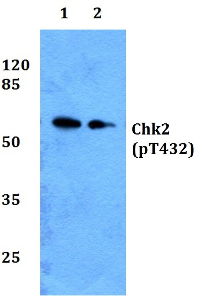 Phospho-CHK2 (Thr432) Antibody in Western Blot (WB)