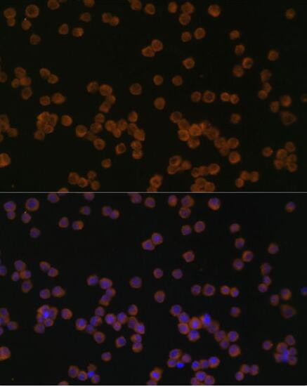 CHI3L1 Antibody in Immunocytochemistry (ICC/IF)