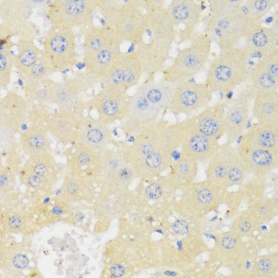 CYP11A1 Antibody in Immunohistochemistry (Paraffin) (IHC (P))