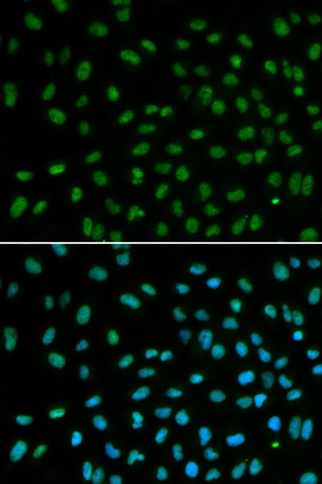 DDB2 Antibody in Immunocytochemistry (ICC/IF)