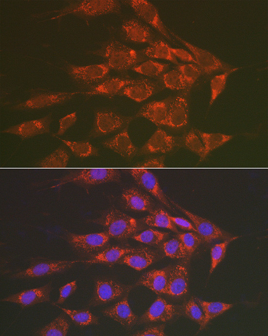 Sorbitol Dehydrogenase Antibody in Immunocytochemistry (ICC/IF)