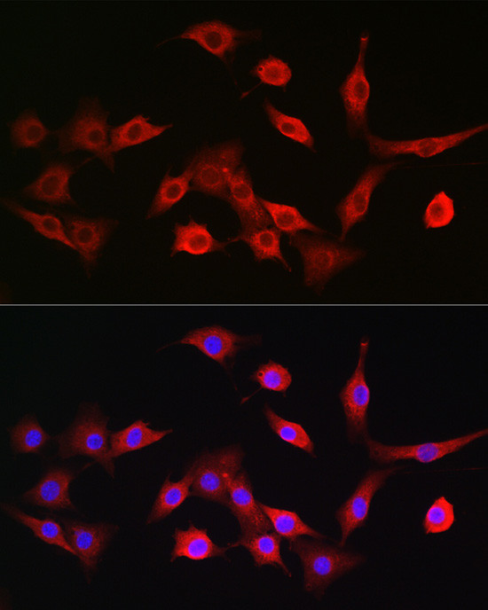 TAP2 Antibody in Immunocytochemistry (ICC/IF)