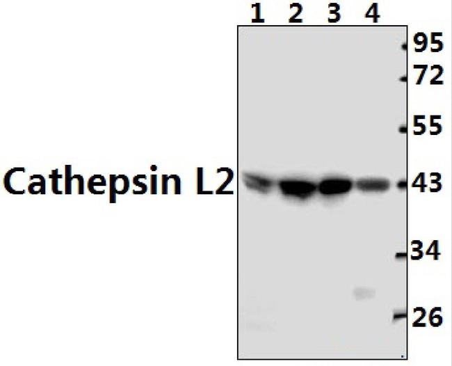 Cathepsin V Antibody in Western Blot (WB)