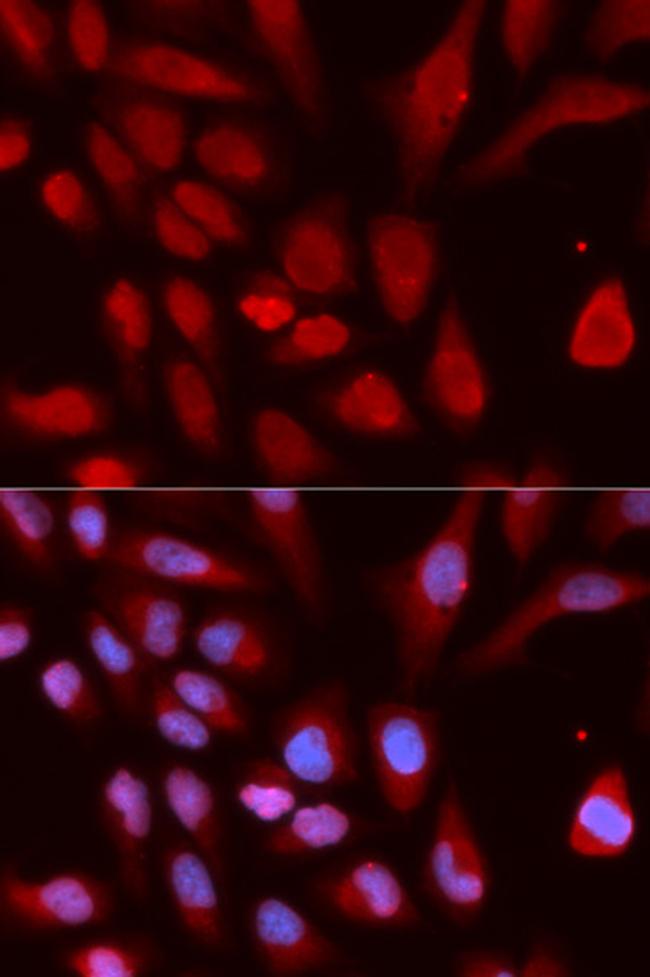 UHRF1 Antibody in Immunocytochemistry (ICC/IF)