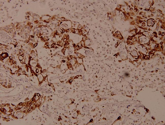 SPINK5 Antibody in Immunohistochemistry (Paraffin) (IHC (P))