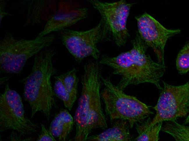 Phospho-AKT1 (Thr450) Antibody in Immunocytochemistry (ICC/IF)