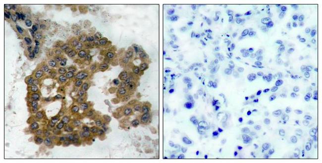 Phospho-AKT2 (Ser474) Antibody in Immunohistochemistry (Paraffin) (IHC (P))