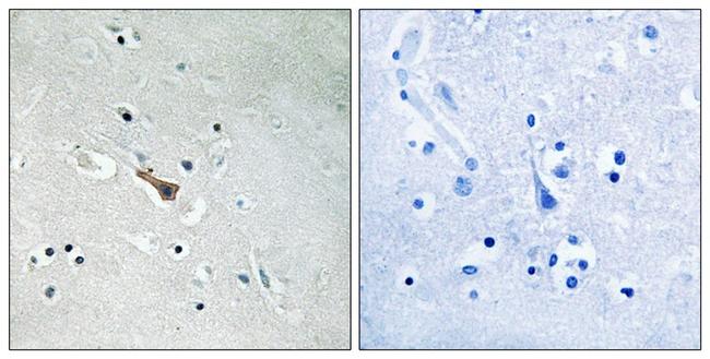 Phospho-APLP2 (Tyr755) Antibody in Immunohistochemistry (Paraffin) (IHC (P))