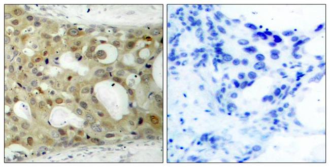 Phospho-Androgen Receptor (Ser650) Antibody in Immunohistochemistry (Paraffin) (IHC (P))