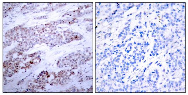 Phospho-ATF4 (Ser245) Antibody in Immunohistochemistry (Paraffin) (IHC (P))