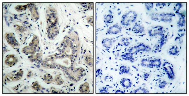 Phospho-BAD (Ser136) Antibody in Immunohistochemistry (Paraffin) (IHC (P))