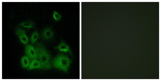 Phospho-Bax (Thr167) Antibody in Immunocytochemistry (ICC/IF)