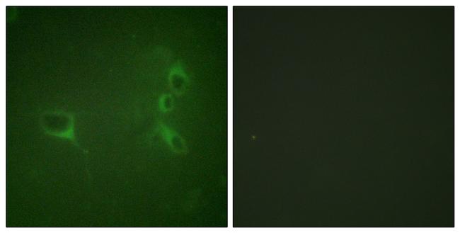 Phospho-BCR (Tyr360) Antibody in Immunocytochemistry (ICC/IF)